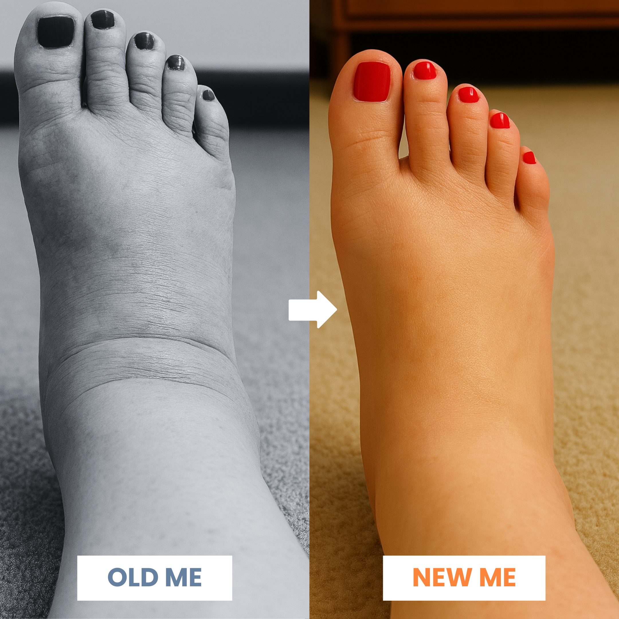 FreedomStep Compression Socks (Unisex)